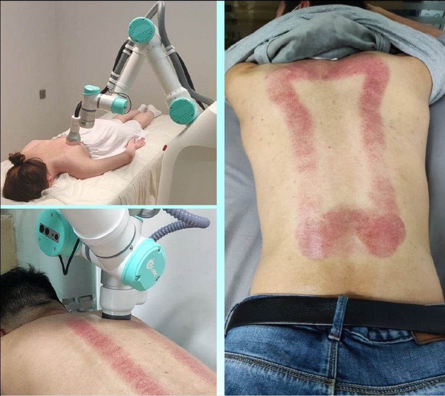 Intelligent AI Massage Robot